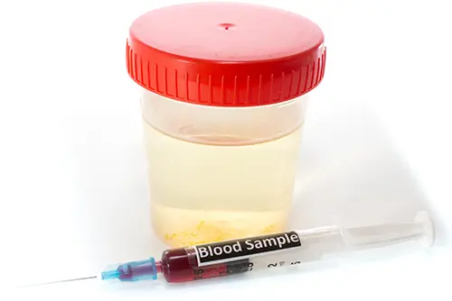 Endocrine and Biomarker Analysis clinical-iStock-469663978