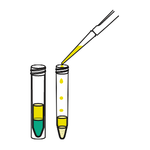Supernatant added into a roQ dSPE tube